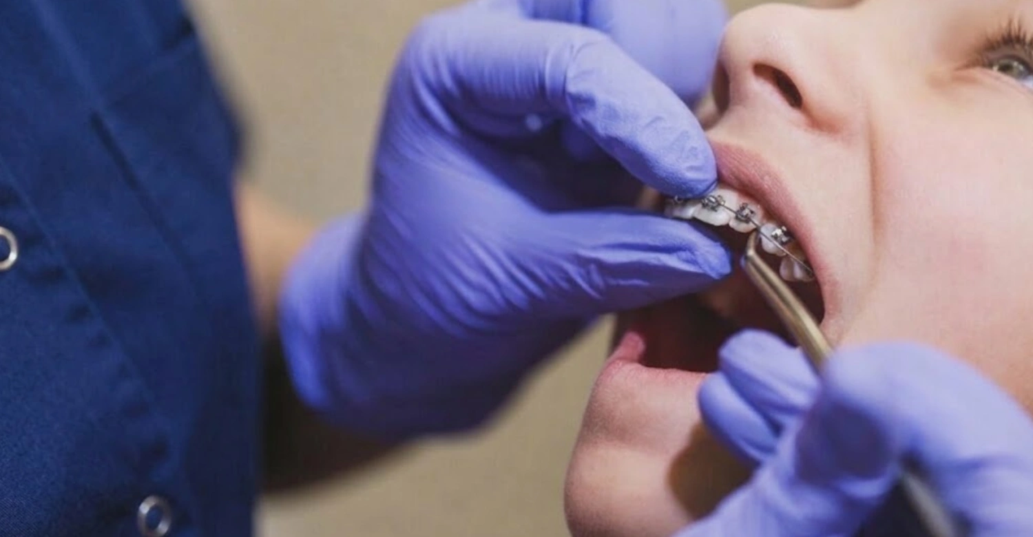 Braces Pain Management Inblog
